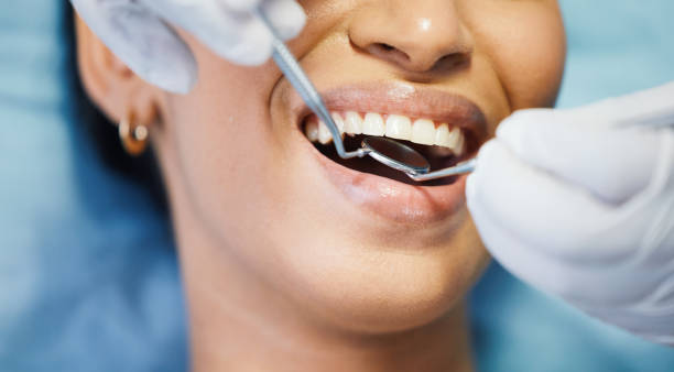 Best Emergency Dental Extractions in Yosemite Lakes, CA